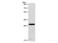 Western Blot analysis of Hela cell using BCL10 Polyclonal Antibody at dilution of 1:950