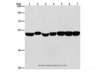 Western Blot analysis of Hela, A431 and hepG2 cell, Mouse brain and liver tissue, Mouse pancreas and Human fetal brain tissue using ENO1 Polyclonal Antibody at dilution of 1:700