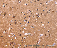 Immunohistochemistry of paraffin-embedded Human brain tissue using CSNK1D Polyclonal Antibody at dilution 1:50