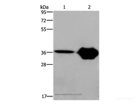 Western Blot analysis of Human fetal brain and Mouse brain tissue using CXCR6 Polyclonal Antibody at dilution of 1:350