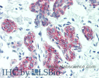 Immunohistochemistry of paraffin-embedded Breast tissue using DSG2 Polyclonal Antibody at dilution of 1:60 (Elabscience® Product Detected by Lifespan) .