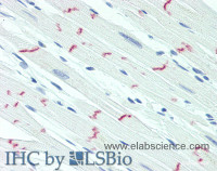 Immunohistochemistry of paraffin-embedded Heart tissue using DSG2 Polyclonal Antibody at dilution of 1:60 (Elabscience® Product Detected by Lifespan) .