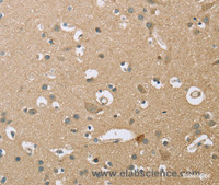 Immunohistochemistry of paraffin-embedded Human brain using ECHS1 Polyclonal Antibody at dilution of 1:35