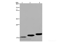 Western Blot analysis of Mouse skeletal muscle, heart and bladder tissue using MYL12B Polyclonal Antibody at dilution of 1:450