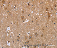 Immunohistochemistry of paraffin-embedded Human brain using GABPB2 Polyclonal Antibody at dilution of 1:30