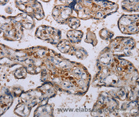 Immunohistochemistry of paraffin-embedded Human placenta using P3H3 Polyclonal Antibody at dilution of 1:50