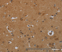 Immunohistochemistry of paraffin-embedded Human brain tissue using ENTPD7 Polyclonal Antibody at dilution 1:60