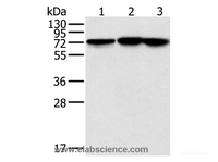 Western Blot analysis of Raji, Jurkat and hela cell using NDUFS1 Polyclonal Antibody at dilution of 1:800