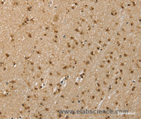Immunohistochemistry of paraffin-embedded Human brain using RNH1 Polyclonal Antibody at dilution of 1:40