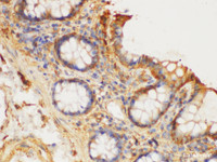 Immunohistochemistry of paraffin-embedded Human colon using S100A6 Polycloanl Antibody at dilution of 1:150