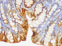 Immunohistochemistry of paraffin-embedded Mouse colon using S100A6 Polycloanl Antibody at dilution of 1:150