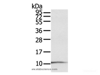 Western Blot analysis of A431 cell using S100P Polyclonal Antibody at dilution of 1:600