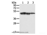 Western Blot analysis of Hepg2, K562 and Jurkat cell using SMARCB1 Polyclonal Antibody at dilution of 1:400