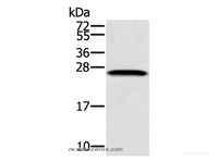 Western Blot analysis of K562 cell using SSX1 Polyclonal Antibody at dilution of 1:400