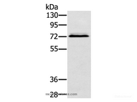 Western Blot analysis of Hepg2 cell using SSX2IP Polyclonal Antibody at dilution of 1:500