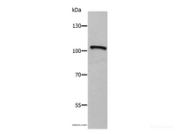 Western Blot analysis of Human fetal brain tissue using ADAMTS5 Polyclonal Antibody at dilution of 1:650