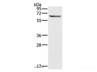 Western Blot analysis of Mouse brain tissue using CRMP1 Polyclonal Antibody at dilution of 1:500