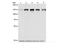 Western Blot analysis of Human fetal small intestine, liver cancer and Lymphoma Lymphoma, 293T and A549 cell using DDB1 Polyclonal Antibody at dilution of 1:500