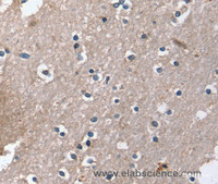 Immunohistochemistry of paraffin-embedded Human brain using DUT Polyclonal Antibody at dilution of 1:30