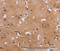 Immunohistochemistry of paraffin-embedded Human brain using ERK1/2 Polyclonal Antibody at dilution of 1:30