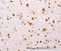 Immunohistochemistry of paraffin-embedded Human brain tissue using TBX2 Polyclonal Antibody at dilution 1:32