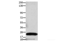 Western Blot analysis of Human colon cancer tissue using Claudin 3 Polyclonal Antibody at dilution of 1:550