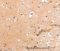 Immunohistochemistry of paraffin-embedded Human brain tissue using GPR64 Polyclonal Antibody at dilution 1:55