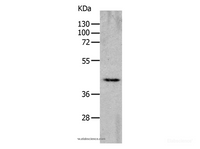 Western Blot analysis of Mouse heart tissue using CHRNA7 Polyclonal Antibody at dilution of 1:700