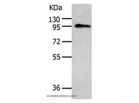 Western Blot analysis of Human liver cancer tissue using AKAP8 Polyclonal Antibody at dilution of 1:500