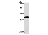 Western Blot analysis of Jurkat cell using PAX5 Polyclonal Antibody at dilution of 1:550