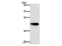 Western Blot analysis of Mouse lung tissue using NKX2-1 Polyclonal Antibody at dilution of 1:700