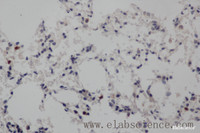 Immunohistochemistry of paraffin-embedded Rat lung using NOTCH1 Polyclonal Antibody at dilution of 1:50