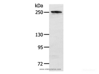 Western Blot analysis of Human colon cancer tissue using NOTCH3 Polyclonal Antibody at dilution of 1:400