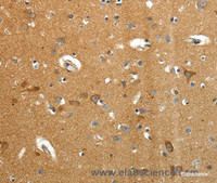 Immunohistochemistry of paraffin-embedded Human brain tissue using AMD1 Polyclonal Antibody at dilution 1:40