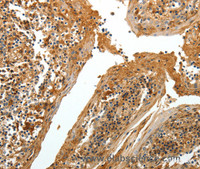 Immunohistochemistry of paraffin-embedded Human tonsil tissue using TNR Polyclonal Antibody at dilution 1:60