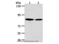 Western Blot analysis of Hela and SKOV3 cell using ADAM11 Polyclonal Antibody at dilution of 1:500