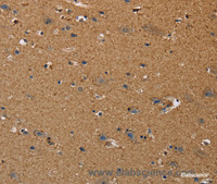 Immunohistochemistry of paraffin-embedded Human brain using DDAH1 Polyclonal Antibody at dilution of 1:50