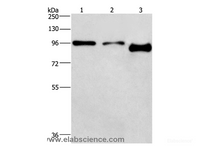 Western Blot analysis of A431 and hela cell, Mouse brain tissue using PIP5K1C Polyclonal Antibody at dilution of 1:500