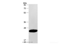 Western Blot analysis of Human fetal muscle tissue using CAV3 Polyclonal Antibody at dilution of 1:500