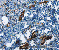 Immunohistochemistry of paraffin-embedded Human tonsil using ACTA2 Polyclonal Antibody at dilution of 1:30