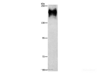 Western Blot analysis of HepG2 cell using ATP7A Polyclonal Antibody at dilution of 1:800