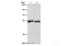 Western Blot analysis of Human placenta and fat tissue using CD36 Polyclonal Antibody at dilution of 1:1000