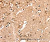 Immunohistochemistry of paraffin-embedded Human brain using AIMP1 Polyclonal Antibody at dilution of 1:40