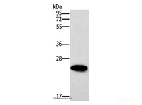 Western Blot analysis of Mouse heart tissue using ERAS Polyclonal Antibody at dilution of 1:500