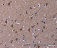 Immunohistochemistry of paraffin-embedded Human brain tissue using TUBGCP2 Polyclonal Antibody at dilution 1:50