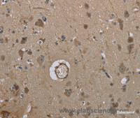 Immunohistochemistry of paraffin-embedded Human brain tissue using MARK4 Polyclonal Antibody at dilution 1:40