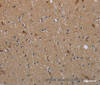 Immunohistochemistry of paraffin-embedded Human brain tissue using MYO7A Polyclonal Antibody at dilution 1:30