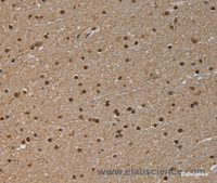 Immunohistochemistry of paraffin-embedded Human brain tissue using NLRP6 Polyclonal Antibody at dilution 1:50