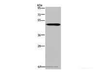 Western Blot analysis of Mouse heart tissue using NDUFS2 Polyclonal Antibody at dilution of 1:250
