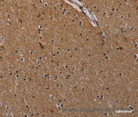 Immunohistochemistry of paraffin-embedded Human brain using IVL Polyclonal Antibody at dilution of 1:50